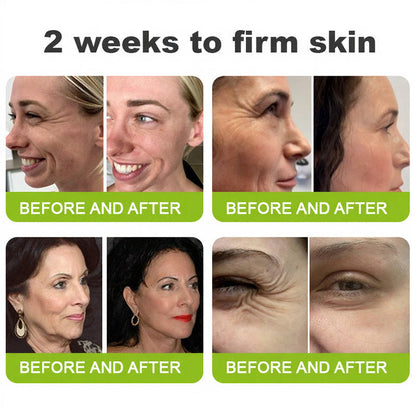 [🔥Last Day 50% OFF]🧬 LOVILDS™ Clinical-Grade Retinol Shot with Visible Firming Power