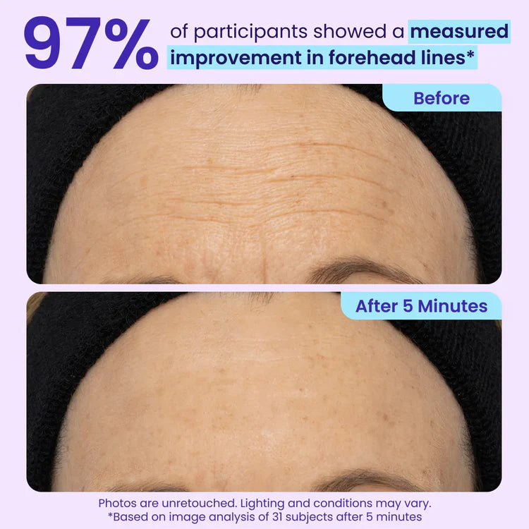 💥New✨HOT SALE 49% OFF🔥Skavix® Instant Lift Eye Gel