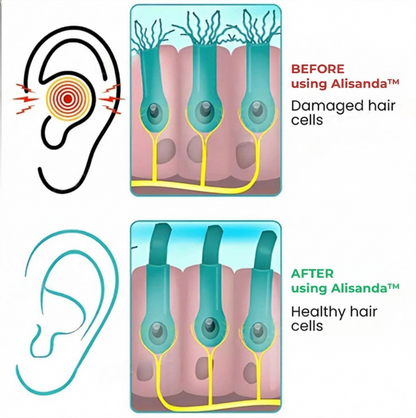 Alisanda®💓HAPPY 2026💓 Tinnitus Relieving Device