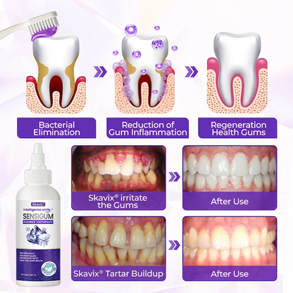 ⏰Last 4 hours Sale: Save 50%-Skavix® SensiGum Fluoride Toothpaste