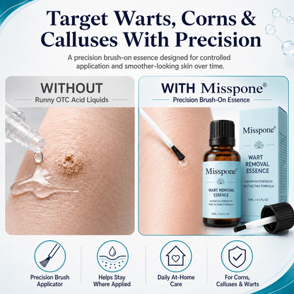 Stop Cursing the Sting: The Precision Acid That Destroys Corns & Warts Without the Burn