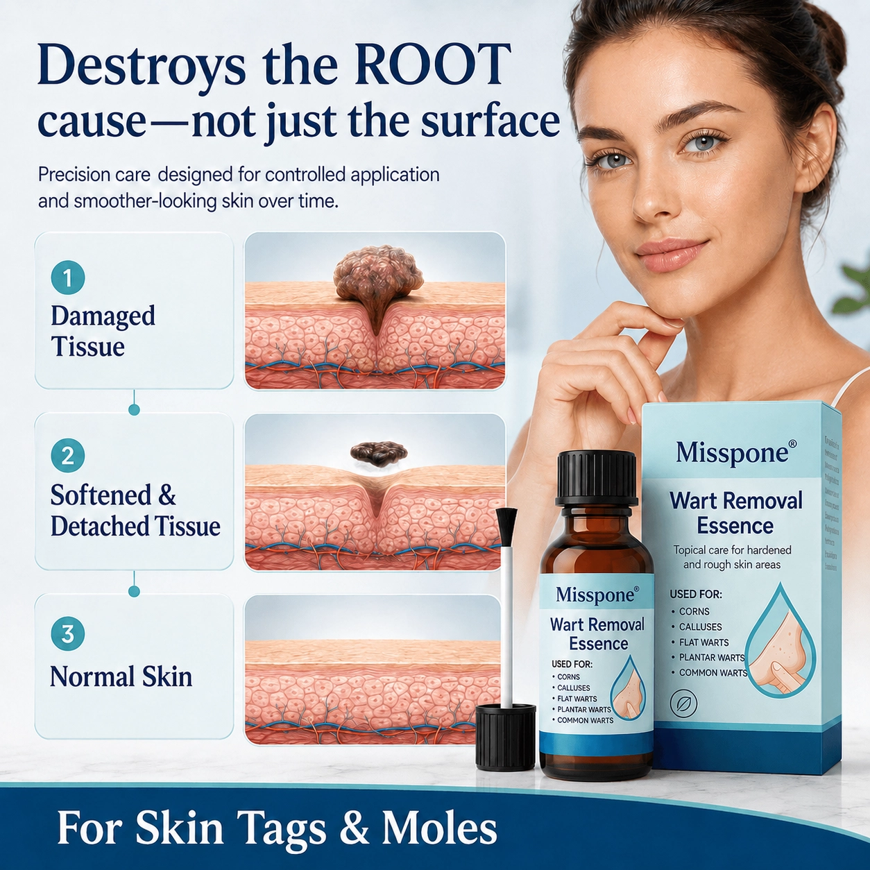 Stop Cursing the Sting: The Precision Acid That Destroys Corns & Warts Without the Burn