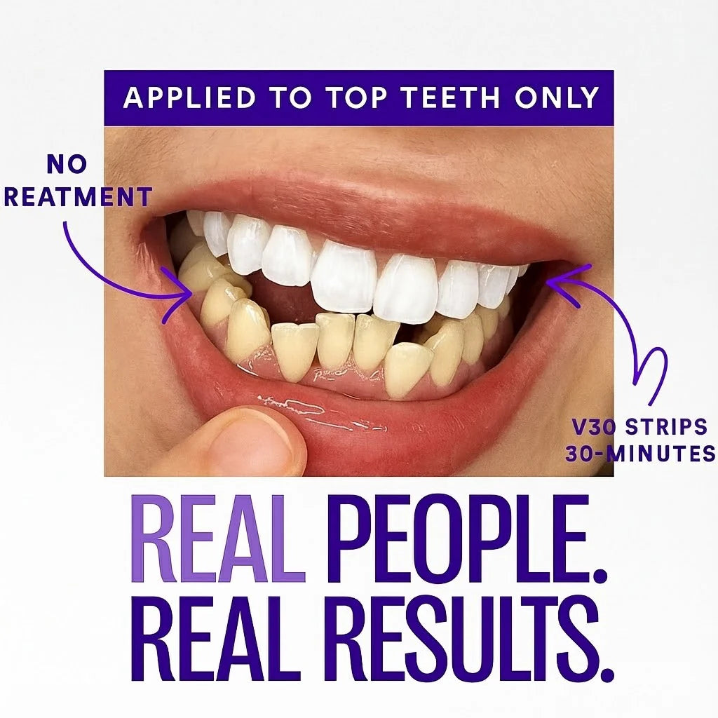Divifit™ Purple Whitening Strips