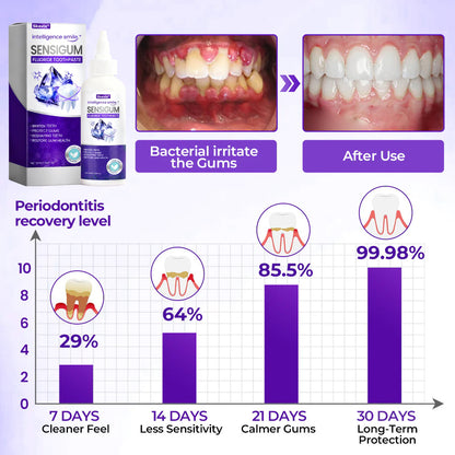 ⏰Last 4 hours Sale: Save 50%-Skavix® SensiGum Fluoride Toothpaste