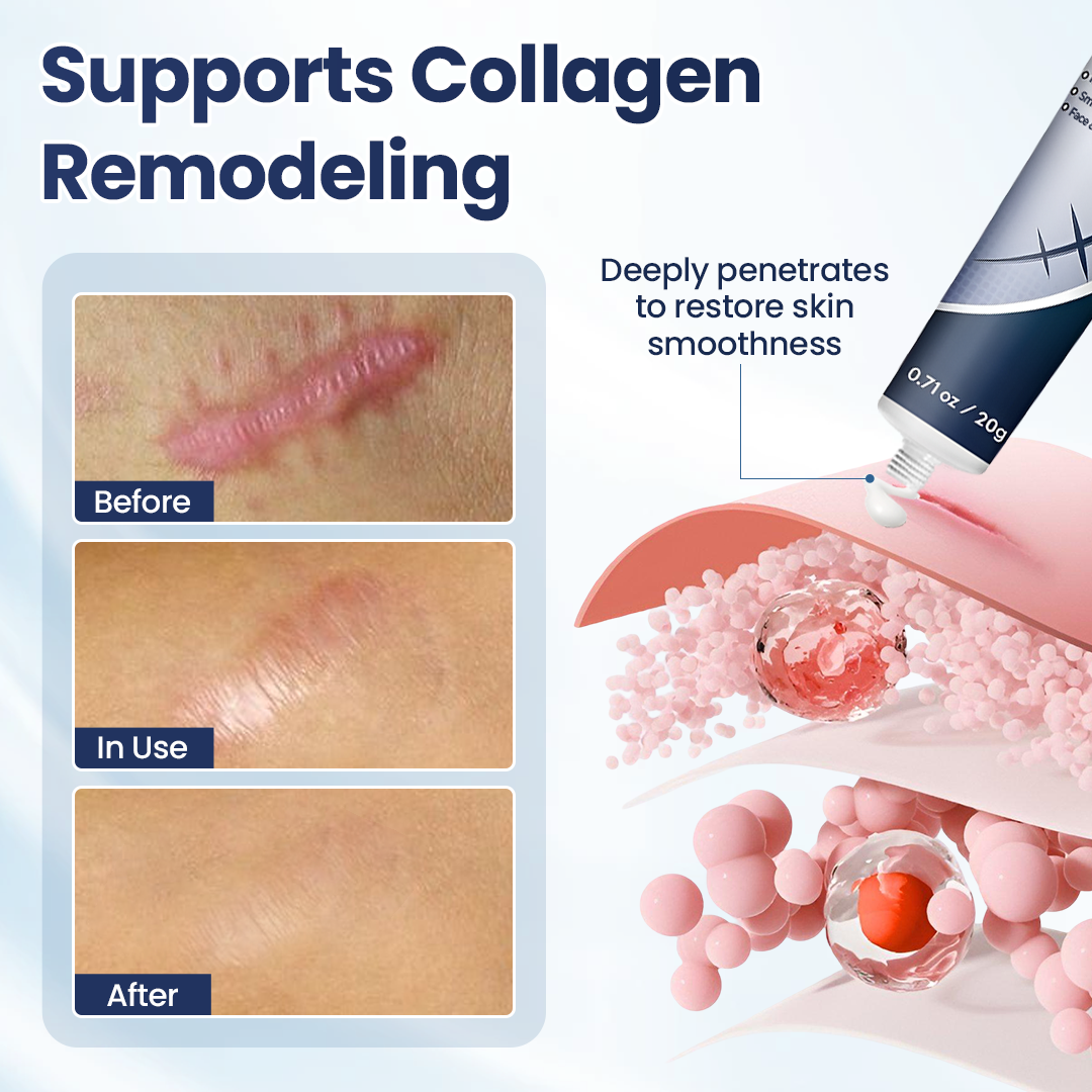 𝑶𝒇𝒇𝒊𝒄𝒊𝒂𝒍 𝑺𝒕𝒐𝒓𝒆 | Juxek® Texture Repair Gel — Say Goodbye to Stubborn Scars & Uneven Texture in 4 Weeks