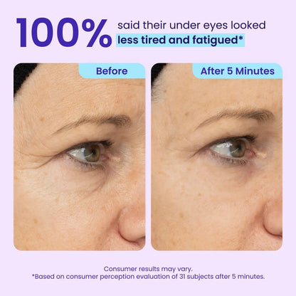 💥New✨HOT SALE 49% OFF🔥Skavix® Instant Lift Eye Gel