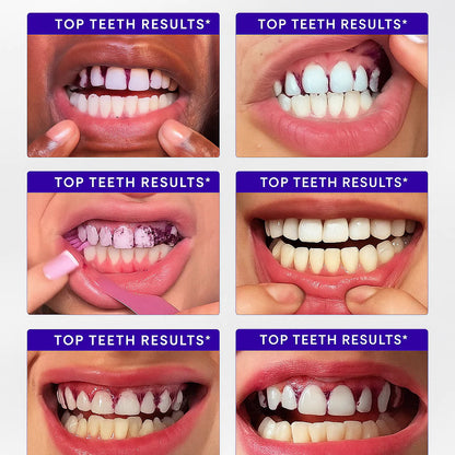 Divifit™ Purple Whitening Strips