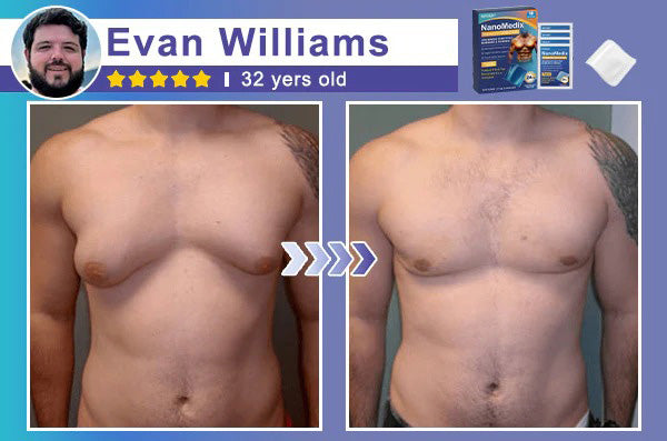 🔥Limited-time 50% sale🔥⚕️💙Slimoly® Gynecomastia Chest Fatburn & Firm Patch